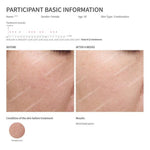 Hot/Cool Sonic Vibration Facial & Eye Massager (Skin Rejuvenator) TB-1589